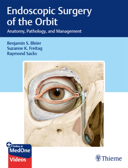 Endoscopic Surgery of the Orbit : Anatomy, Pathology, and Management, EPUB eBook