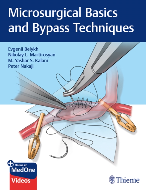 Microsurgical Basics and Bypass Techniques, EPUB eBook