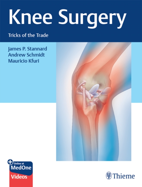 Knee Surgery : Tricks of the Trade, EPUB eBook