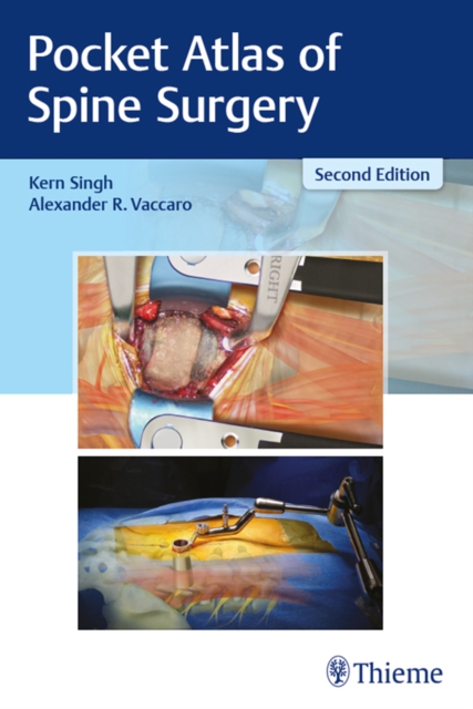 Pocket Atlas of Spine Surgery, EPUB eBook