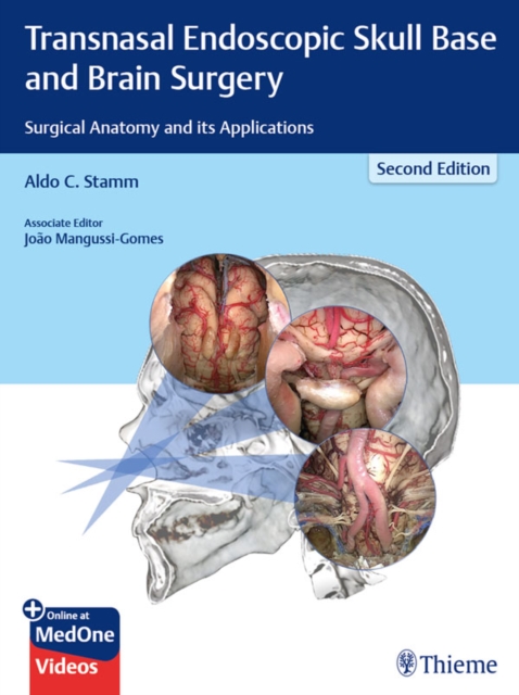 Transnasal Endoscopic Skull Base and Brain Surgery : Surgical Anatomy and its Applications, EPUB eBook