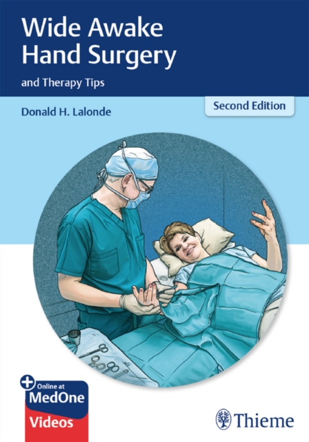 Wide Awake Hand Surgery and Therapy Tips, EPUB eBook