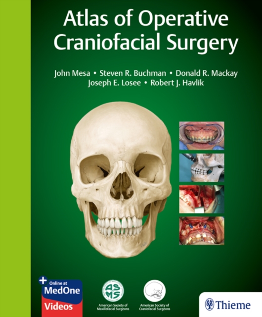Atlas of Operative Craniofacial Surgery, EPUB eBook