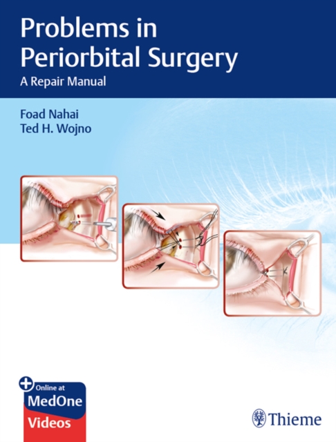 Problems in Periorbital Surgery : A Repair Manual, EPUB eBook