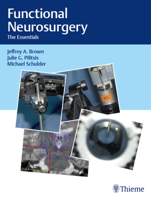Functional Neurosurgery : The Essentials, EPUB eBook