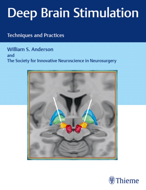 Deep Brain Stimulation : Techniques and Practices, EPUB eBook
