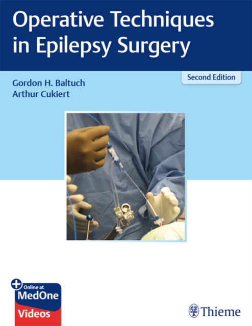 Operative Techniques in Epilepsy Surgery, EPUB eBook