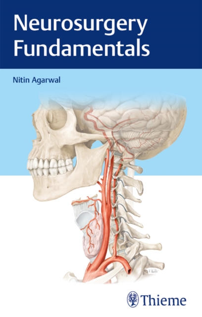 Neurosurgery Fundamentals, EPUB eBook