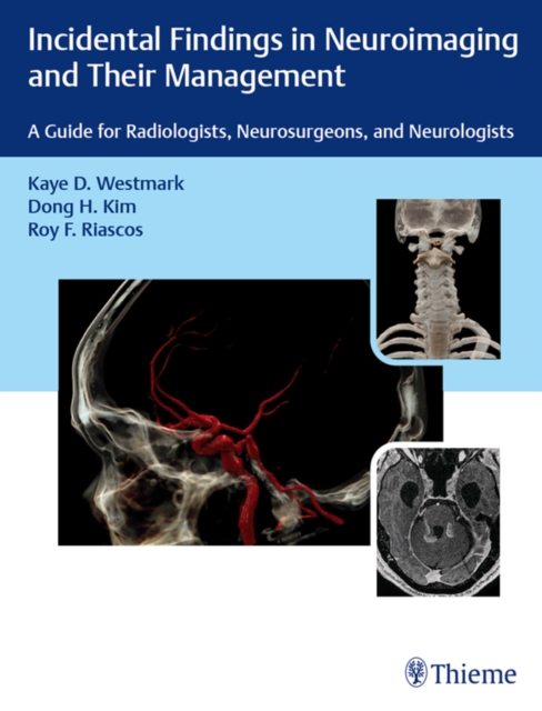 Incidental Findings in Neuroimaging and Their Management : A Guide for Radiologists, Neurosurgeons, and Neurologists, EPUB eBook