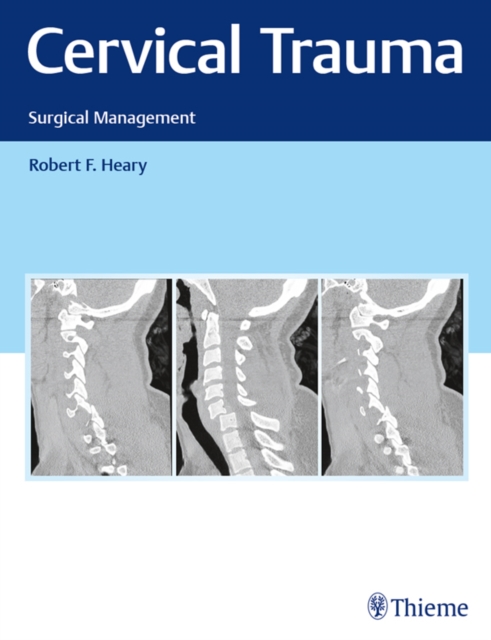 Cervical Trauma : Surgical Management, EPUB eBook