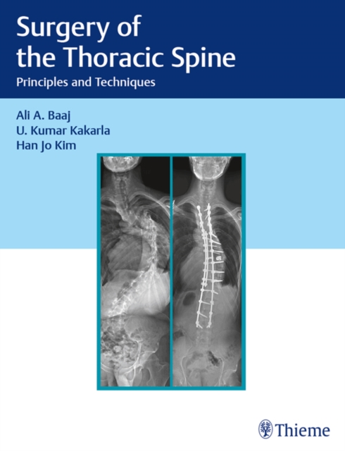 Surgery of the Thoracic Spine : Principles and Techniques, EPUB eBook