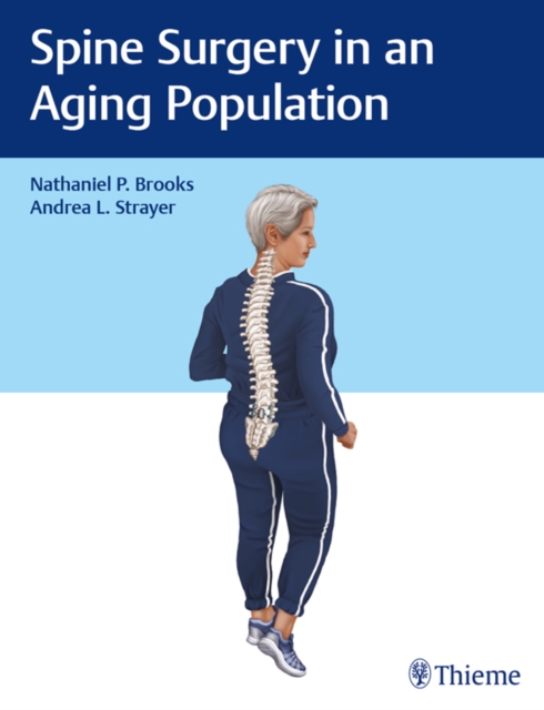 Spine Surgery in an Aging Population, EPUB eBook