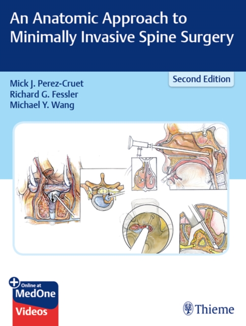 An Anatomic Approach to Minimally Invasive Spine Surgery, EPUB eBook