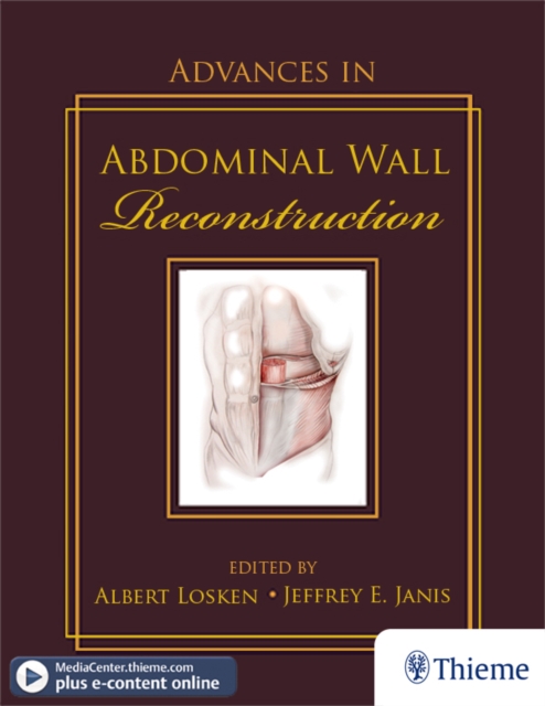 Advances in Abdominal Wall Reconstruction, EPUB eBook