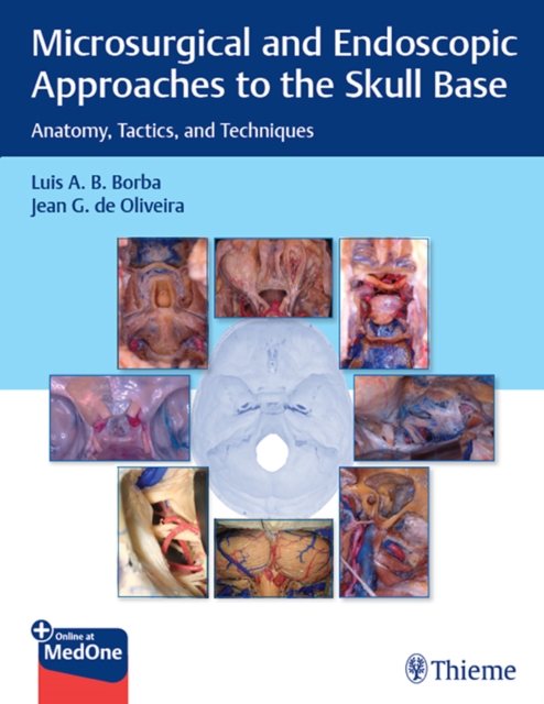 Microsurgical and Endoscopic Approaches to the Skull Base : Anatomy, Tactics, and Techniques, EPUB eBook