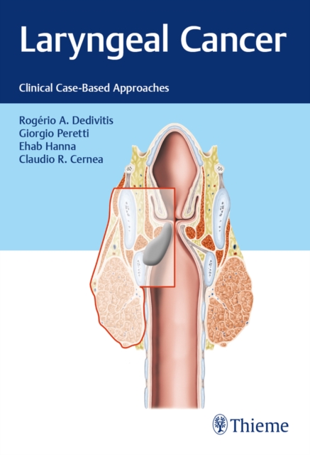 Laryngeal Cancer : Clinical Case-Based Approaches, EPUB eBook