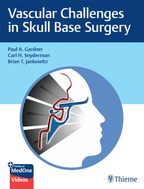 Vascular Challenges in Skull Base Surgery, EPUB eBook