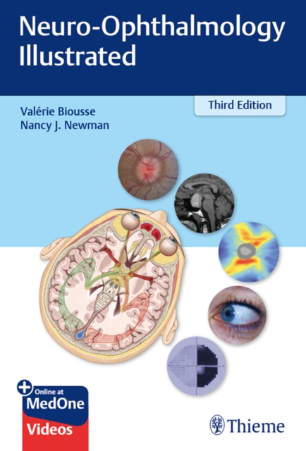 Neuro-Ophthalmology Illustrated, EPUB eBook