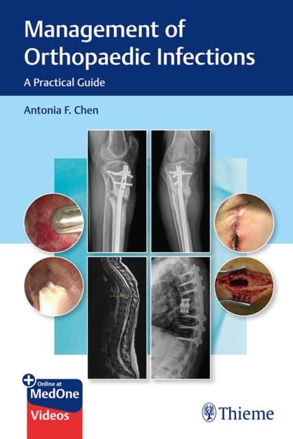 Management of Orthopaedic Infections : A Practical Guide, EPUB eBook
