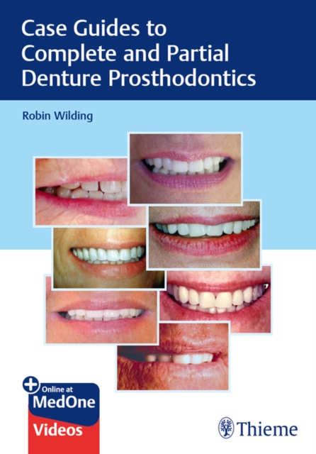 Case Guides to Complete and Partial Denture Prosthodontics, EPUB eBook