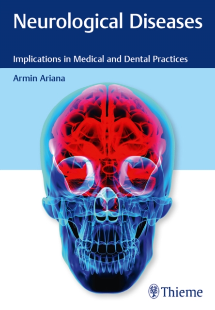 Neurological Diseases : Implications in Medical and Dental Practices, EPUB eBook