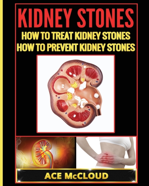 Kidney Stones : How to Treat Kidney Stones: How to Prevent Kidney Stones, Paperback / softback Book