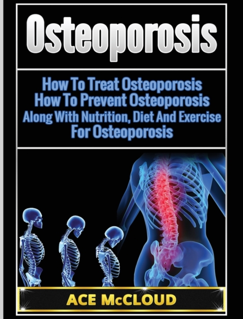 Osteoporosis : How to Treat Osteoporosis: How to Prevent Osteoporosis: Along with Nutrition, Diet and Exercise for Osteoporosis, Hardback Book