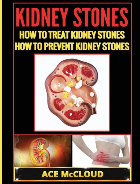 Kidney Stones : How to Treat Kidney Stones: How to Prevent Kidney Stones, Hardback Book