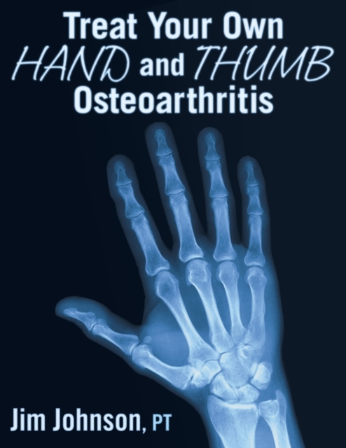 Treat Your Own Hand and Thumb Osteoarthritis, Paperback / softback Book