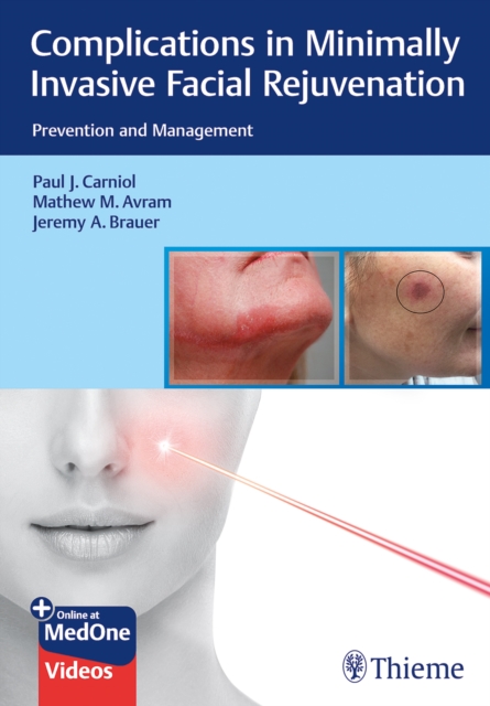 Complications in Minimally Invasive Facial Rejuvenation : Prevention and Management, Multiple-component retail product, part(s) enclose Book
