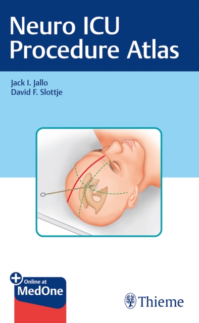 Neuro ICU Procedure Atlas, Multiple-component retail product, part(s) enclose Book