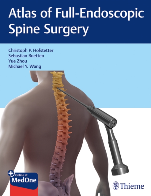 Atlas of Full-Endoscopic Spine Surgery, Multiple-component retail product, part(s) enclose Book