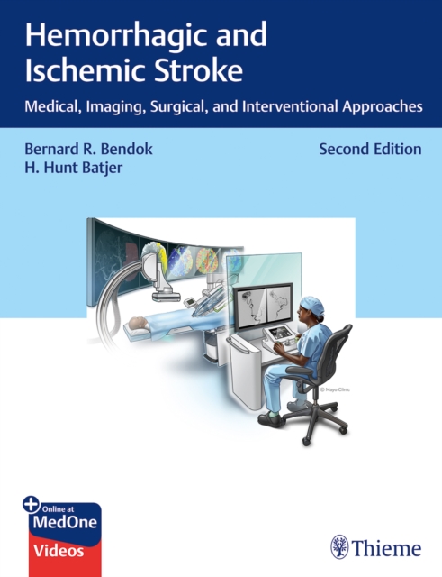 Hemorrhagic and Ischemic Stroke, Hardback Book