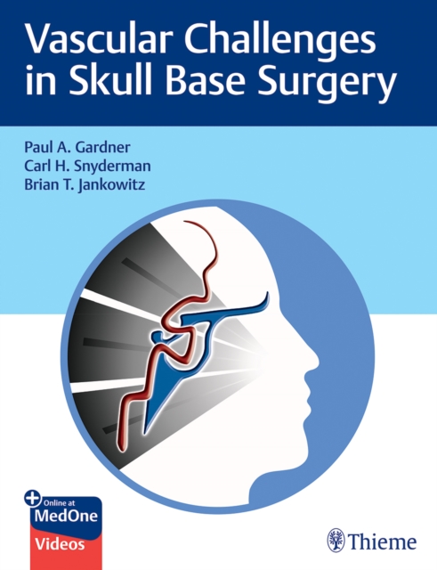 Vascular Challenges in Skull Base Surgery, Multiple-component retail product, part(s) enclose Book