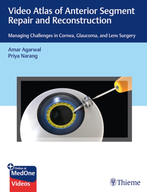 Video Atlas of Anterior Segment Repair and Reconstruction : Managing Challenges in Cornea, Glaucoma, and Lens Surgery, Multiple-component retail product, part(s) enclose Book