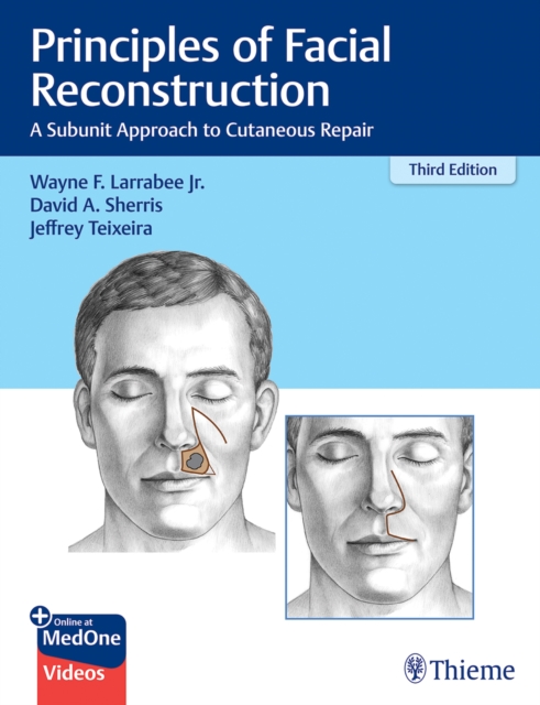 Principles of Facial Reconstruction : A Subunit Approach to Cutaneous Repair, Multiple-component retail product, part(s) enclose Book