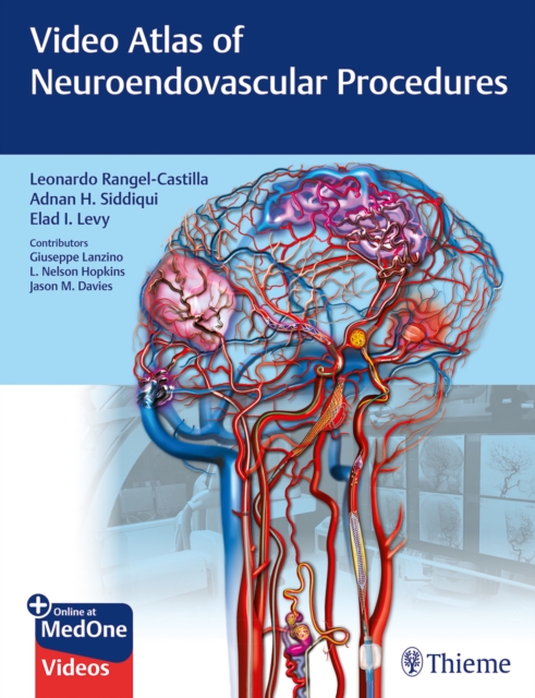 Video Atlas of Neuroendovascular Procedures, Multiple-component retail product, part(s) enclose Book