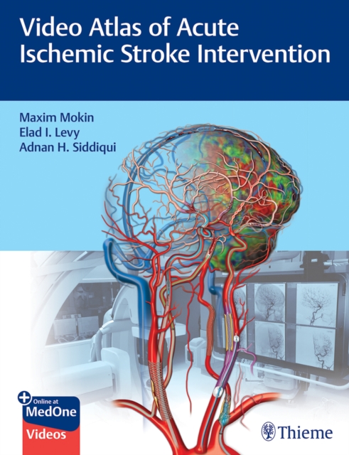 Video Atlas of Acute Ischemic Stroke Intervention, Multiple-component retail product, part(s) enclose Book