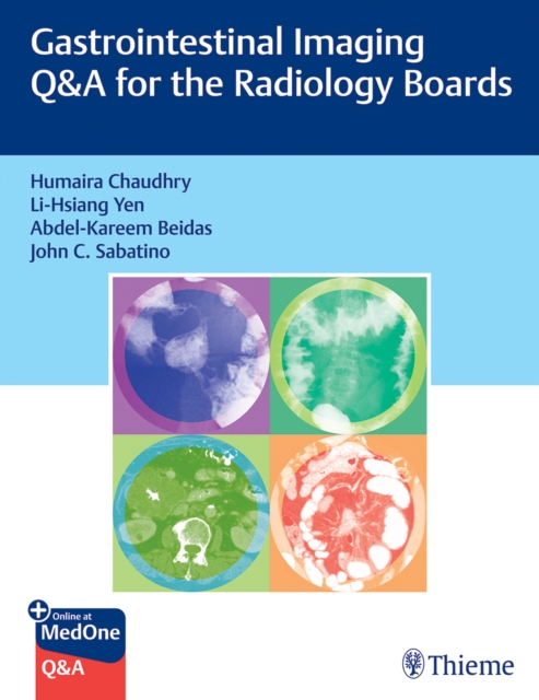 Gastrointestinal Imaging Q&A for the Radiology Boards, Paperback / softback Book