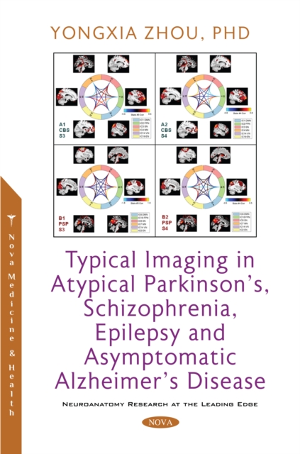 Typical Imaging in Atypical Parkinson's, Schizophrenia, Epilepsy and Asymptomatic Alzheimer's Disease, PDF eBook