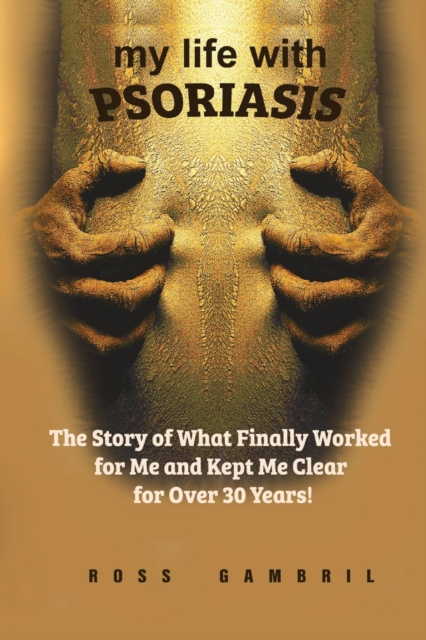 my life with PSORIASIS : The story of what finally worked for me and kept me clear for over 30 years!, Paperback / softback Book