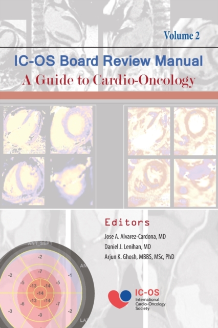 International Cardio-Oncology Society (IC-OS) Board Review Manual A Guide to Cardio-Oncology Volume 2, Paperback / softback Book