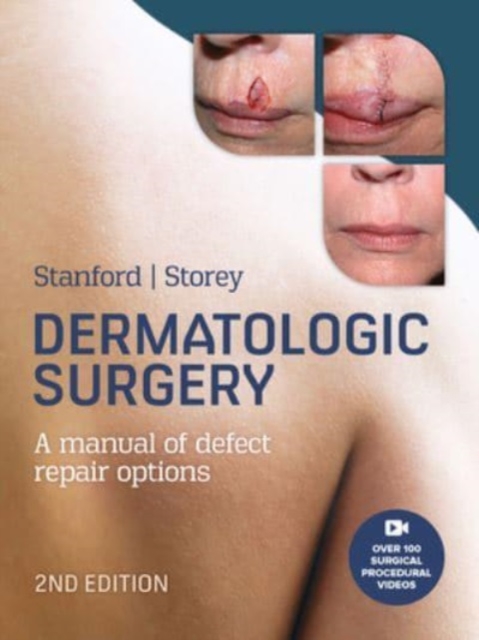 Dermatologic Surgery, Hardback Book