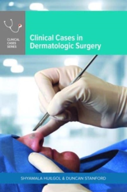 Clinical Cases in Dermatologic Surgery, Paperback / softback Book