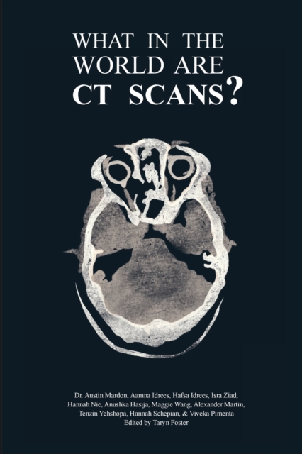 What in the World are CT Scans?, Paperback / softback Book