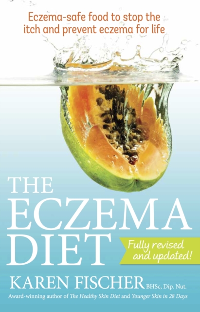 The Eczema Diet (2nd edition) : Eczema-safe food to stop the itch and prevent eczema for life, EPUB eBook