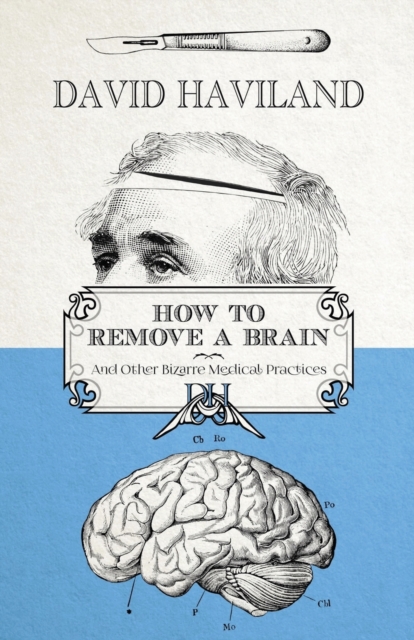 How to Remove a Brain : and other bizarre medical practices and procedures, Paperback / softback Book