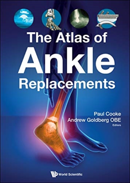 Atlas Of Ankle Replacements, The, Hardback Book