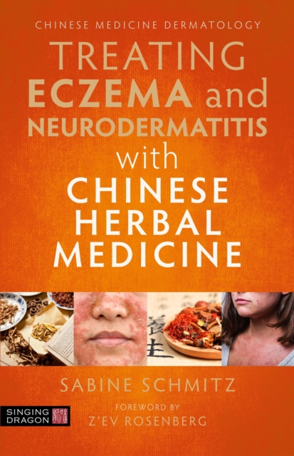 Treating Eczema and Neurodermatitis with Chinese Herbal Medicine, Paperback / softback Book