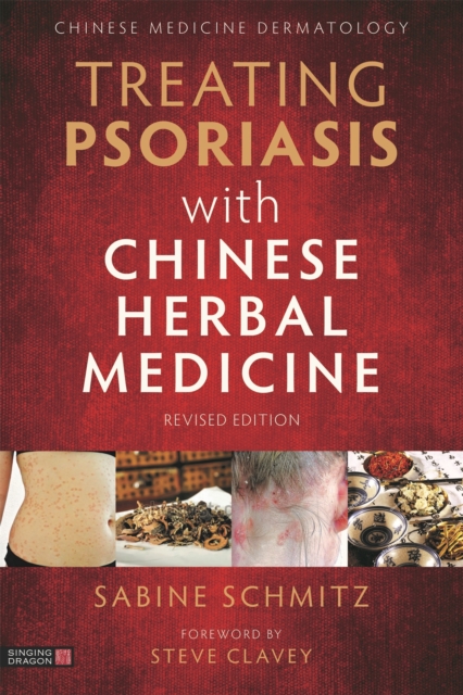 Treating Psoriasis with Chinese Herbal Medicine (Revised Edition) : A Practical Handbook, Paperback / softback Book